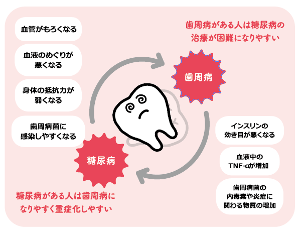 糖尿病がある人は歯周病になりやすく重症化しやすい　歯周病がある人は糖尿病の治療が困難になりやすい